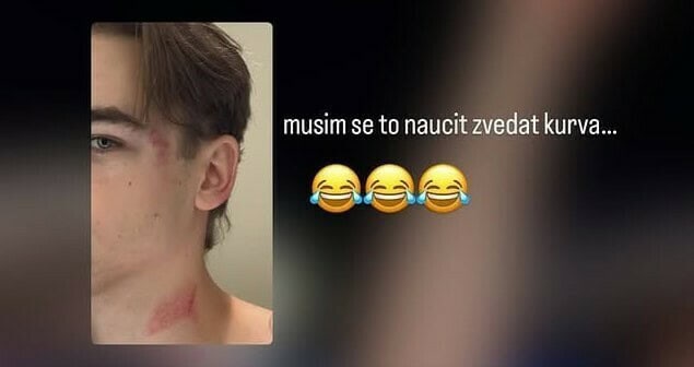 PR ялалтын баярын үеэр цомоо өөр дээрээ унагажээ 2 PR ялалтын баярын үеэр цомоо өөр дээрээ унагажээ